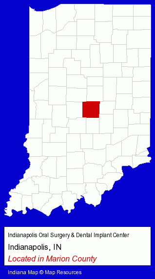 Indiana counties map, showing the general location of Indianapolis Oral Surgery & Dental Implant Center